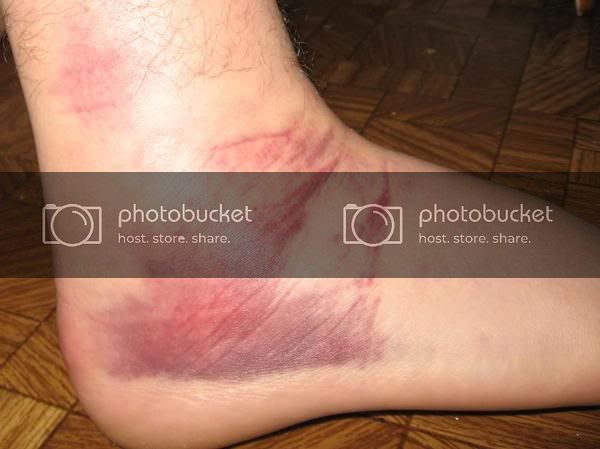 ankle2.jpg